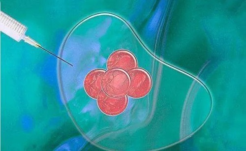 人工受孕和試管嬰兒哪個好